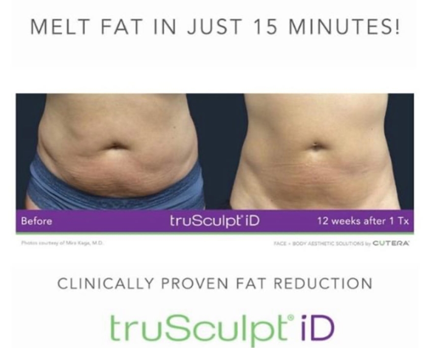 trusculpt id