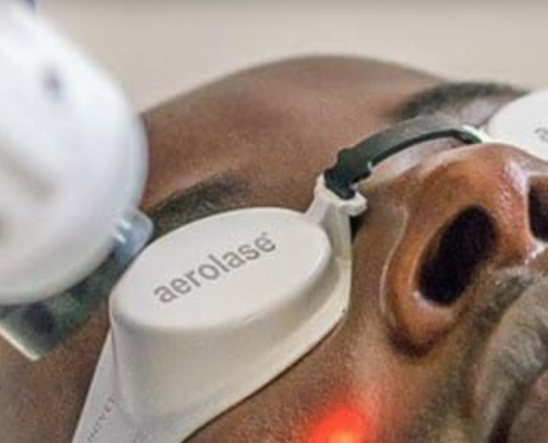 Aerolase